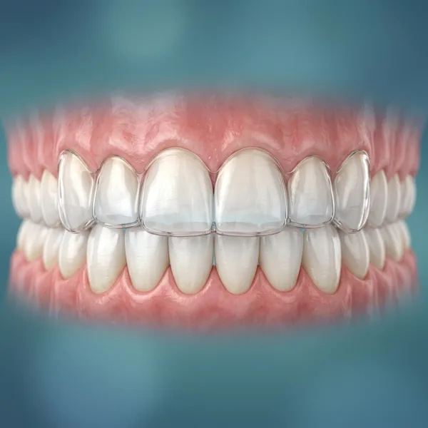 Orthodontics Braces and Clear Aligners Treatment in Gudivada