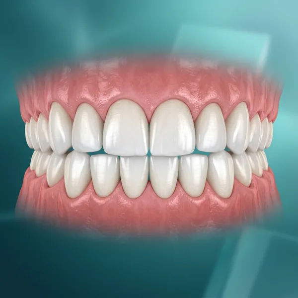 Cosmetic Dentistry Veneers and Smile Makeovers in Gudivada