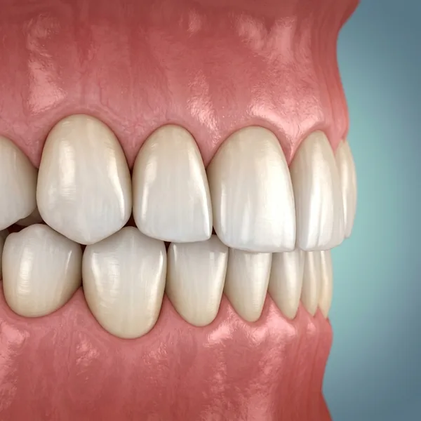 Cosmetic Smile Makeover before treatment - Patient #01 at Krishna Dental Gudivada